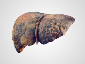 Artichoke on Liver