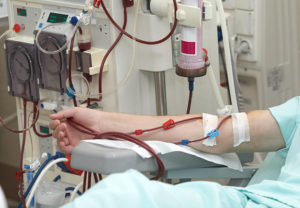 Kidney Dialysis session 