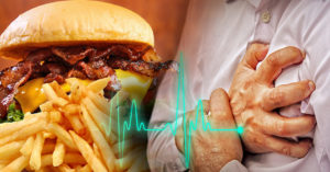 Foods to Avoid for Heart Attack