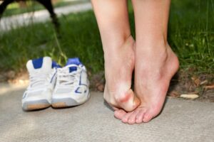 Chronic athlete's foot