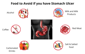 Foods to avoid with an Ulcer