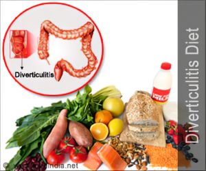 Diverticulitis Foods To Eat