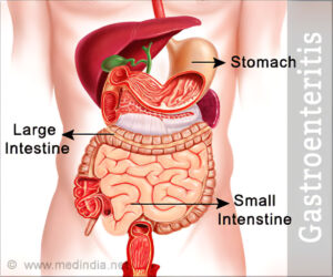 What to eat during gastroenteritis 