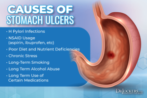 Home Remedies for Stomach Ulcer