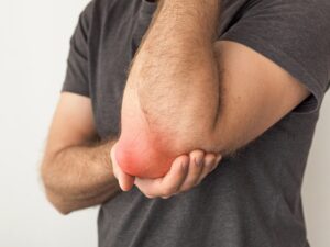 Elbow Bursitis Treatment at Home