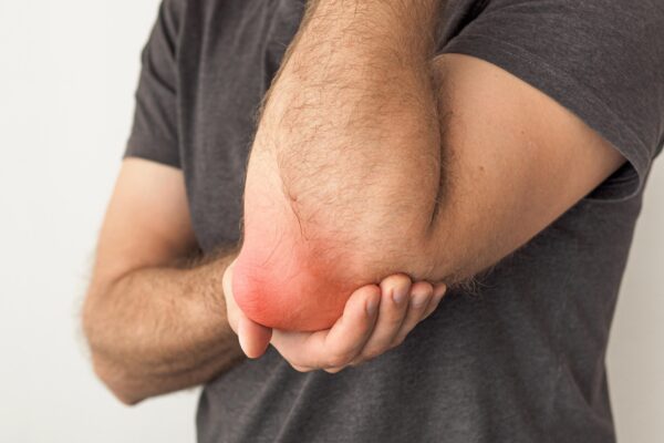 Elbow Bursitis Treatment at Home