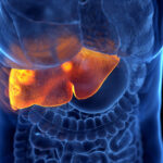 Liver Cirrhosis Diet