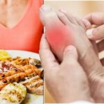 Worst foods for gout
