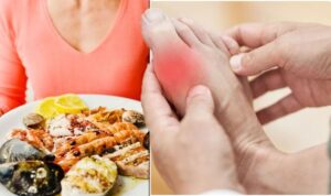 Worst foods for gout