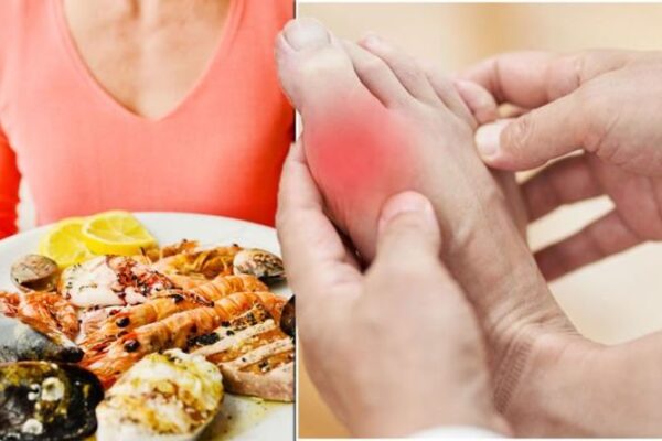 Worst foods for gout