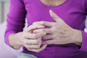 Managing Psoriatic Arthritis