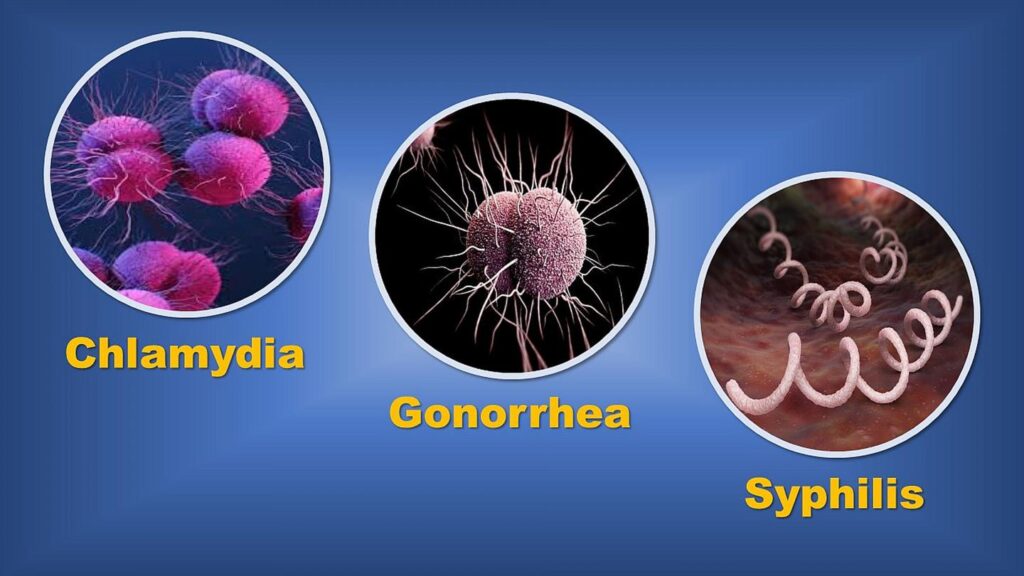 Impact of Sexually transmitted diseases