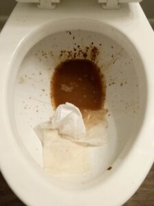 Diarrhea Home Remedies 