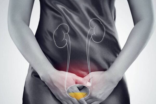 Home Remedies for Cystitis