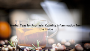 Herbal Teas for Psoriasis 