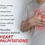 Reasons for Heart Palpitation