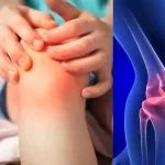 Chronic Childhood Arthritis