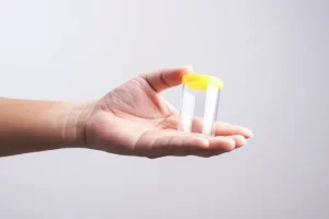 Yellow Semen: Causes and What It Means