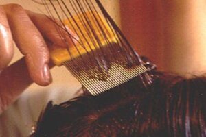How to Remove Lice from Hair Permanently at Home