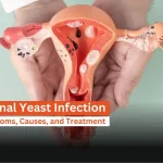 Home Remedies for Yeast Infection