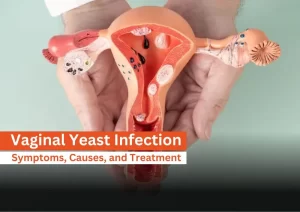 Home Remedies for Yeast Infection