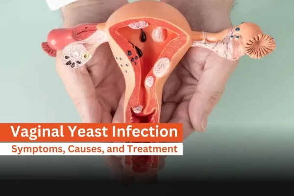Home Remedies for Yeast Infection