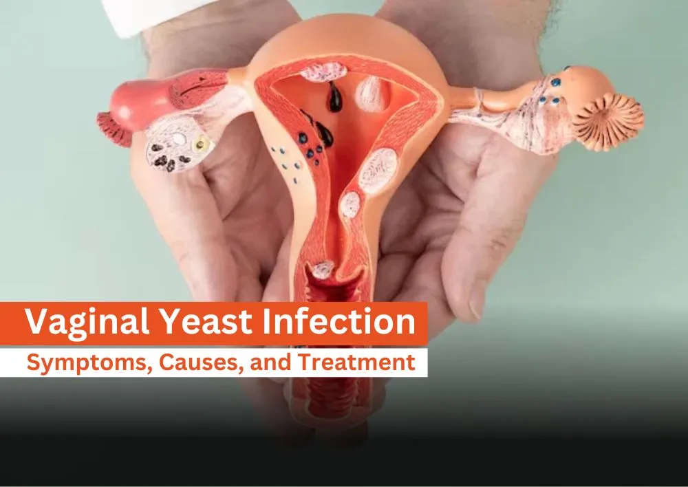 Home Remedies for Yeast Infection
