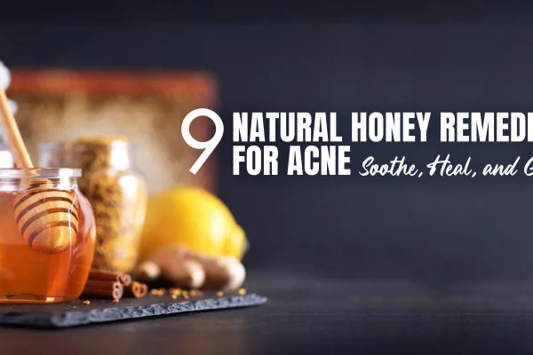 Home Remedies for Pimples