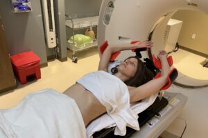 Radiotherapy for Breast Cancer May Lower Short-Term Risk of Alzheimer’s Disease, New Study Suggests