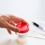 What Causes Blood in Sperm and Urine