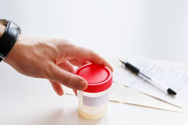 What Causes Blood in Sperm and Urine