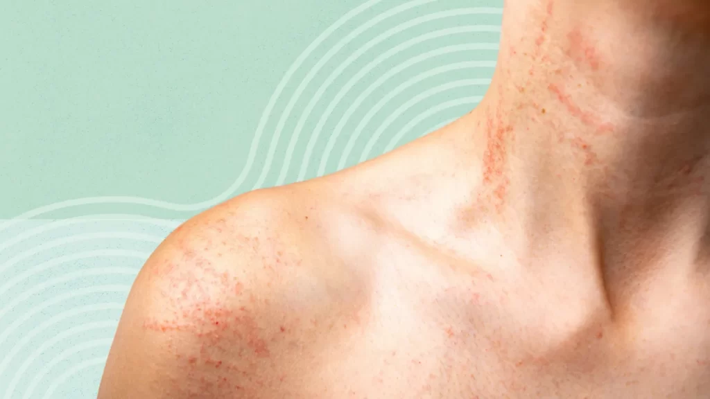 causes of red spots on skin