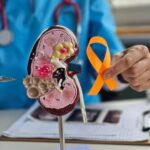 How to Prevent Kidney Failure