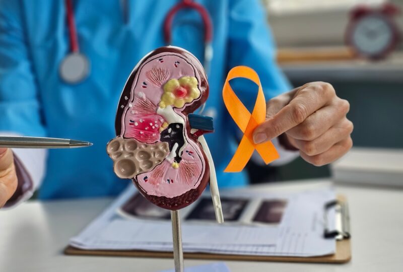 How to Prevent Kidney Failure