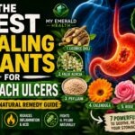 Best Healing Plants for Stomach Ulcers