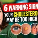 6 Warning Signs Your Cholesterol May Be Too High