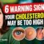 6 Warning Signs Your Cholesterol May Be Too High