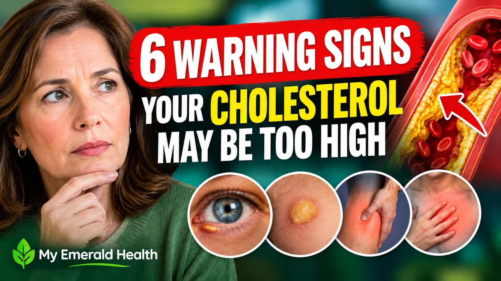 6 Warning Signs Your Cholesterol May Be Too High
