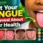 What Your Tongue Can Reveal About Your Health