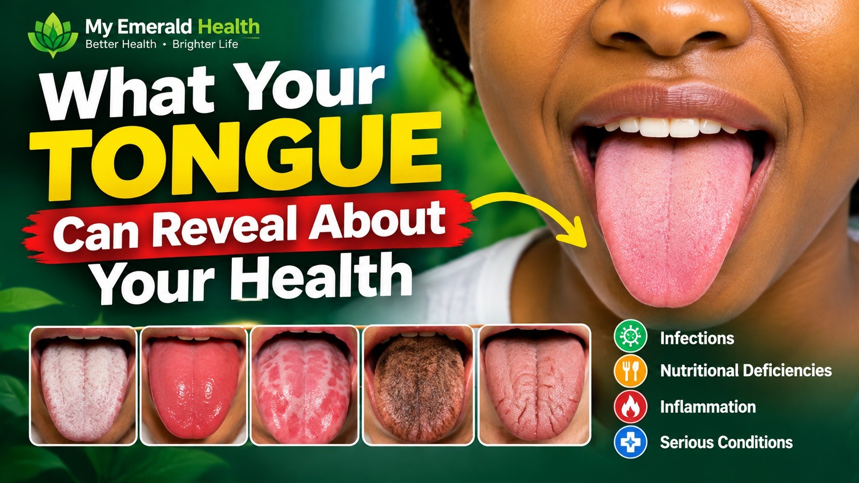 What Your Tongue Can Reveal About Your Health