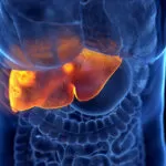 Liver Cirrhosis Diet