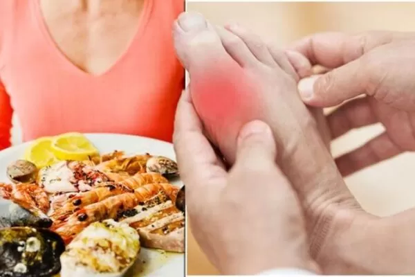 Worst foods for gout