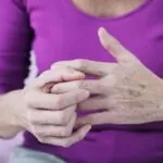 MANAGING PSORIATIC ARTHRITIS