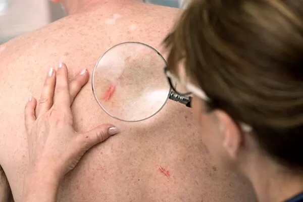 Novel mRNA Cancer Vaccine Enhances Immune Response Against Fatal Brain Tumors