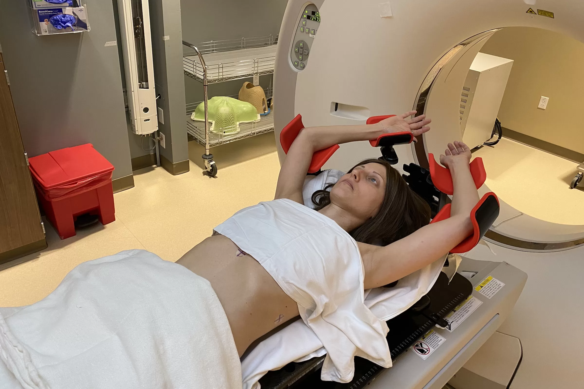 Radiotherapy for Breast Cancer May Lower Short-Term Risk of Alzheimer’s Disease, New Study Suggests